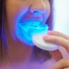 Glorysmile Teeth Whitening